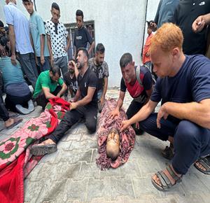 مواطنون ينقلون جثامين شهداء ومصابين إلى مستشفى الشفاء في مدينة غزة بعد استهداف إسرائيلي لمجموعة من المواطنين قرب مستشفى اليمن السعيد في مخيم جباليا شمال قطاع غزة